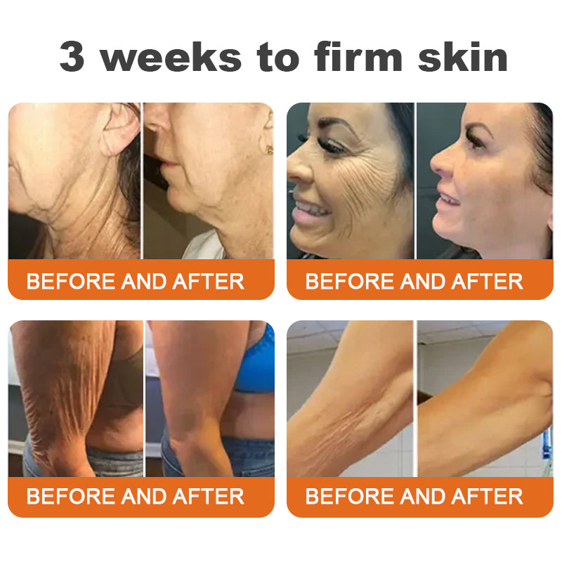 Made and Shipped from USA✨Nexisify® Botox Bee Venom Firming Serum Stick(🔥LAST DAY 70% OFF)💄