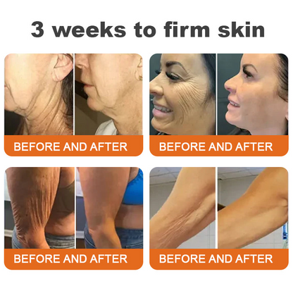 Made and Shipped from USA✨Nexisify® Botox Bee Venom Firming Serum Stick(🔥LAST DAY 70% OFF)💄
